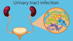 What is the full form of UTI?