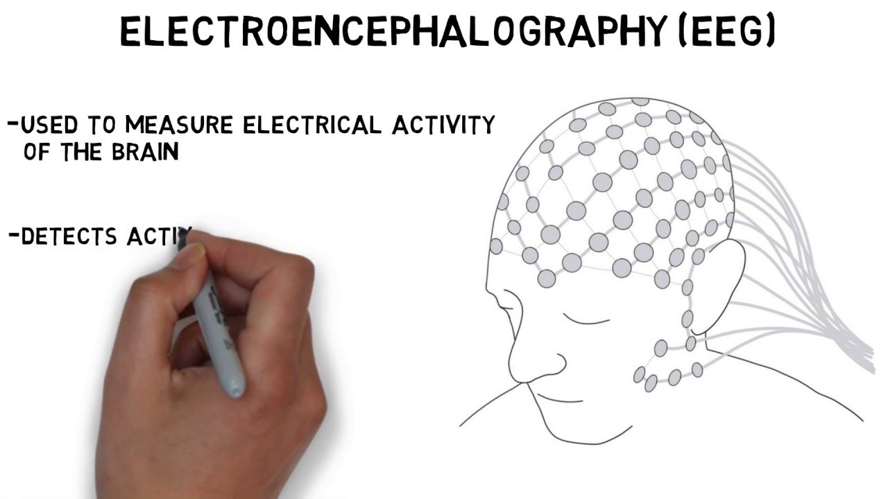 What is the full form of EEG?